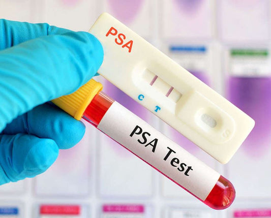 CI004-Tumor Marker-Prostate Specific Antigen Test Kit - WHOLESALE Pack - 1000 Kits 25Test/Kit