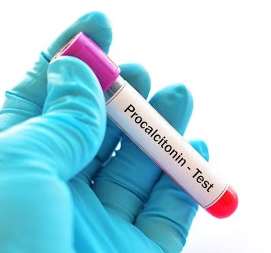 CI108-Cardiac Marker-Procalcitonin Test Kit - WHOLESALE Pack - 1000 Kits 25Test/Kit